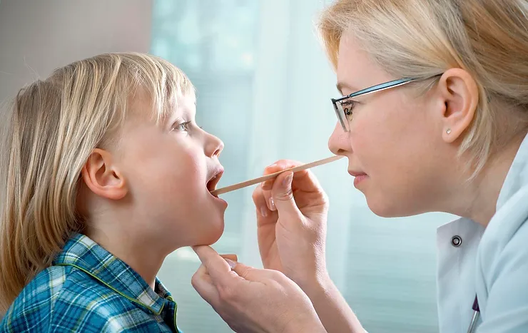 Bademcik İltihabı (Akut Tonsilit)