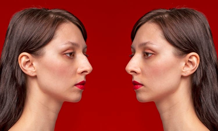 Estetik Cerrahide Hastanın Beklentileri ve Gerçekçi Sonuçlar