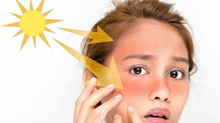 Güneş Koruyucular ve Yaşlanma UV Işınlarının Cildimize Etkileri