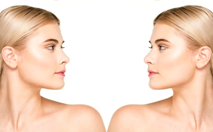Burun Estetiği ve Yüz Hatlarına Etkisi