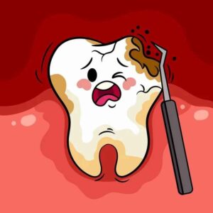6 Maddede Diş Çürümesinin Nedenleri